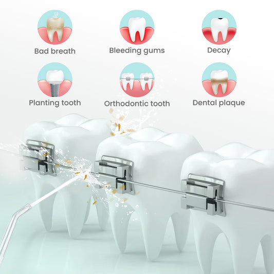 2022 Nicefeel New Water Flosser Dental Oral Irrigator Professional Teeth Cleaner