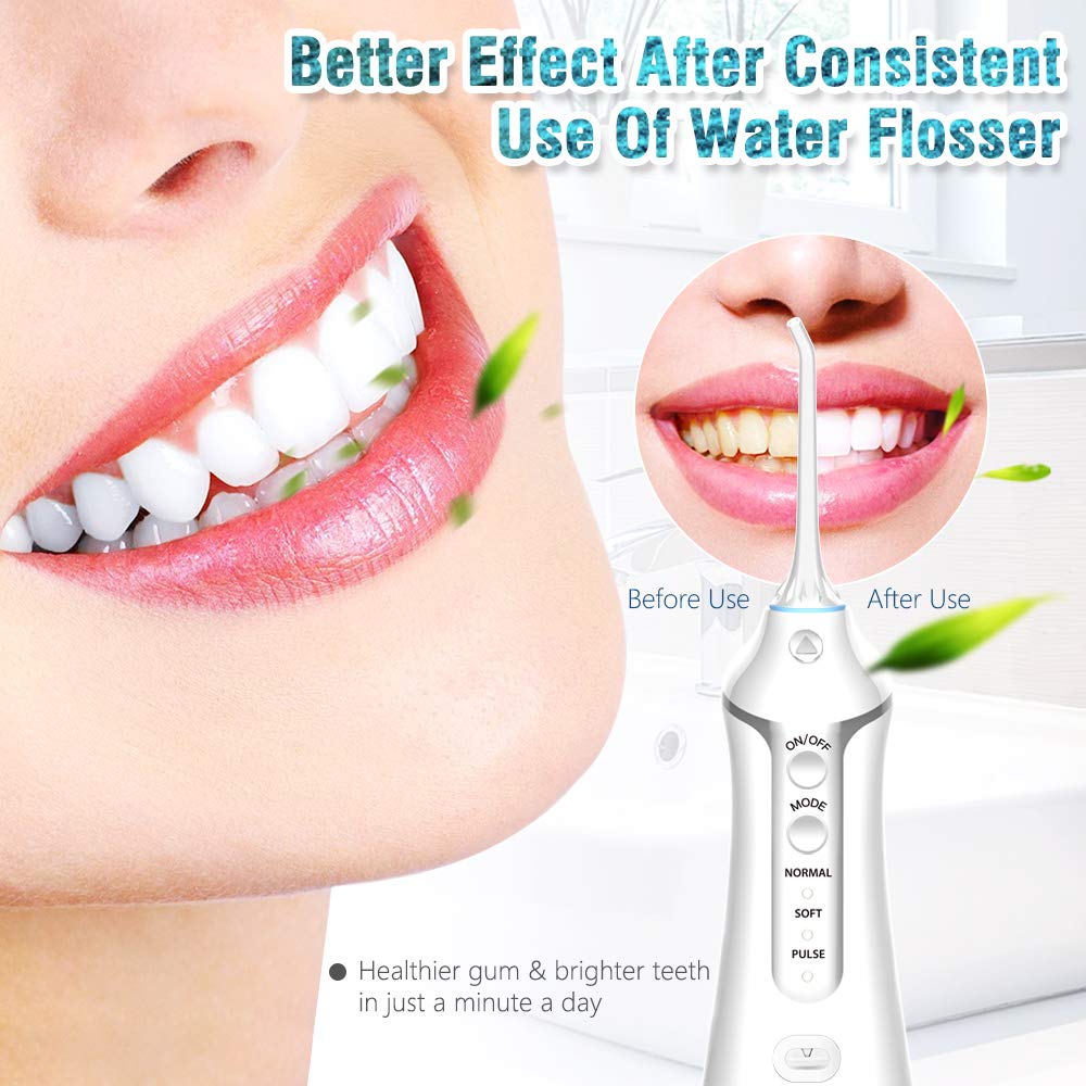 Cordless Water Flosser