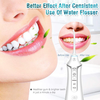 Cordless Water Flosser